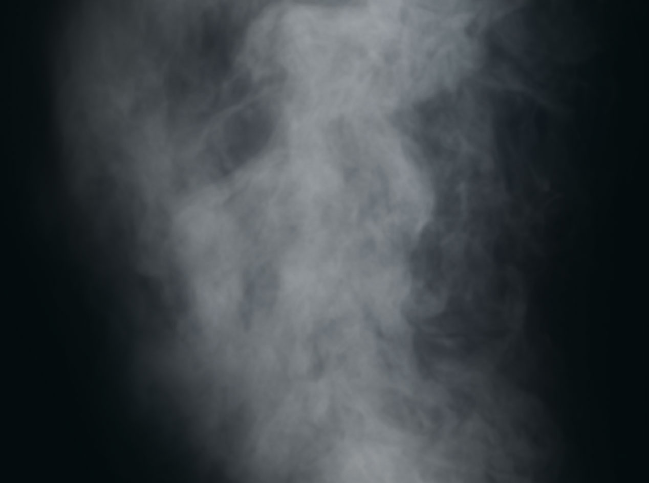 AEG steamfie